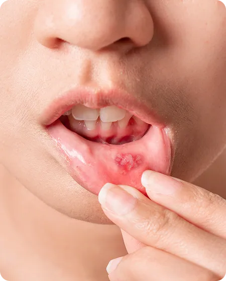 oral-care
